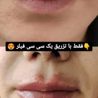 ژل بوتاکس پی از پی مزو فیشال میکرو فیلر بیکنی|خدمات آرایشگری و زیبایی|مشهد, فرهنگیان (شهرک غرب)|دیوار