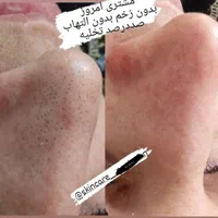 مدل فشیال تخصصی پوست وحلزون تراپی