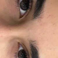 کاشت مژه اکستنشن