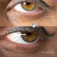 پونصد هزار تومان تخفیف روی خدمات ریمو|خدمات آرایشگری و زیبایی|شیراز, شریف‌آباد|دیوار