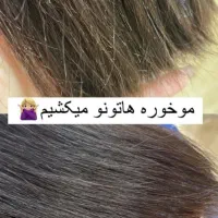 تخفیفات فوق العاده موخوره گیری واصلاح صورت وابرو