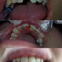 دندانپزشکی.کامپوزیت.ارتودنسی.روکش.عصبکشی|خدمات آرایشگری و زیبایی|کرمانشاه, |دیوار