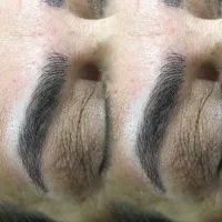 مدل میکروبلیدینگ