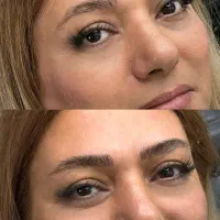 میکروبلیدینگ و شیدینگ|خدمات آرایشگری و زیبایی|تهران, تهرانپارس شرقی|دیوار