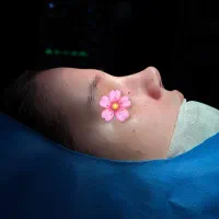 عمل بینی فقط با ۲۵ تومن تا پایان مهر ماه در تهران|خدمات آرایشگری و زیبایی|قم, بکایی|دیوار