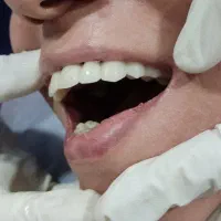 درمان دندان با شرایط دلخواه + ویزیت رایگان|خدمات آرایشگری و زیبایی|مشهد, منزل آباد|دیوار
