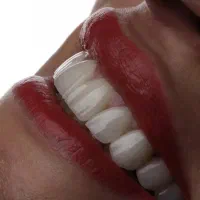 کامپوزیت دیجیتال و لمینیت با شرایط استثنایی در لار|خدمات آرایشگری و زیبایی|لار, |دیوار