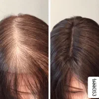 پک تقویت مو