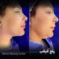لیزیک چشم /لیپوماتیک /آبدومینو/ کاشت مو/بلفارو|خدمات آرایشگری و زیبایی|کرمانشاه, |دیوار