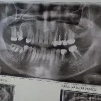 نرس و پذیرش دندانپزشکی خانم