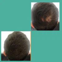 معجزه ی قرن