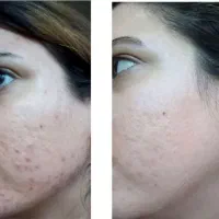جوانسازی و مراقبت تخصصی پوست بدون تزریق|آرایشی، بهداشتی، درمانی|مشهد, الهیه|دیوار