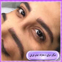 میکروبلیدینگ فیبروز شیدلب بنمژه ریموو|خدمات آرایشگری و زیبایی|شیراز, کوی زهرا|دیوار