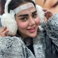 کاشت ابرو دائمی با قیمت مناسب