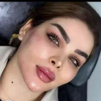 تزریق فیلر (ژل) مزو، بوتاکس