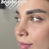 جراحی عمل بینی لیپو ابدو لیفت پروتز پیکرتراشی|خدمات آرایشگری و زیبایی|تهران, تهران پارس|دیوار