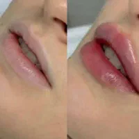 مدل ژل