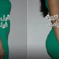 مرکز تخصصی فیلر بادی (فرم دهی بدن و زیبایی اندام)|خدمات آرایشگری و زیبایی|تهران, تهرانسر شرقی|دیوار