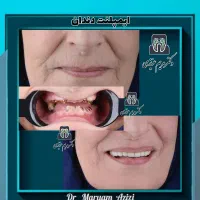 جشنواره دندان، مرکز تخصصی ایمپلنت دندانپزشکی شیراز