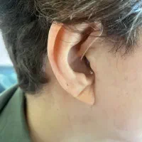 تجویز سمعک‌ فراهوشمند شارژی|پزشکی|تهران, نیاوران|دیوار