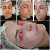 آموزش مزو نیدلینگ +تکنیک پوست کره ای+کاموفلاژ بدن|خدمات آموزشی|مشهد, هنرستان|دیوار