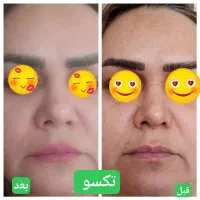 توی ۳۰ روز پوستت سفید و رویایی کن