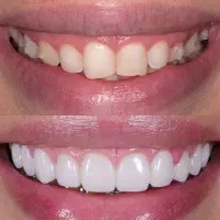 دندانپزشکی در اردبیل با شرایط خوب
