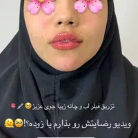 جشنواره خدمات زیبایی در کلینیک زیبایی توسط پزشک|خدمات آرایشگری و زیبایی|قم, زنبیل آباد|دیوار