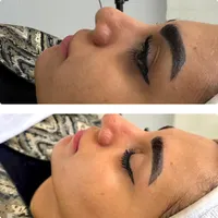 پاکسازی و فیشال تخصصی مشاوره رایگان|خدمات آرایشگری و زیبایی|تهران, حکمت|دیوار