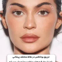 آموزش بوتاکس و فیلر (ژل)|خدمات آموزشی|امیدیه, |دیوار