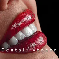 دندانپزشکی لمینت الهیه منطقه ۱ کامپوزیت سرامیکی|خدمات آرایشگری و زیبایی|تهران, الهیه|دیوار