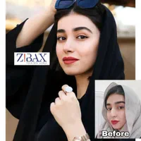 جراحی بینی در شیراز/نوبتگیری +وام+مشاوره