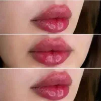 اف  ویژه فقط تا اخر هفته فول فیس  و ژل و بوتاکس