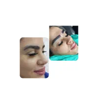 کاشت
