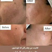 مدل کاشت ناخن و فشیال و اصلاح|خدمات آرایشگری و زیبایی|پرند, فاز ۴|دیوار