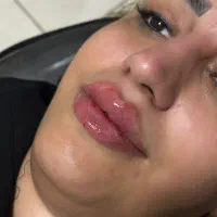 ژل و بوتاکس فرنیا بیوتی|خدمات آرایشگری و زیبایی|شهریار, شهرک وائین|دیوار