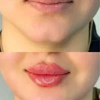 تزریق با منطقی ترین قیمت و کیفیت در مشهد