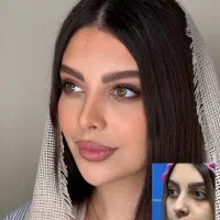 جراحی بینی،شروع زیبایی در دی با ۵۰درصد تخفیف