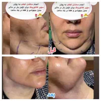 دکتر اکرم آقابیگی پوست مو زیبایی|خدمات آرایشگری و زیبایی|ملایر, |دیوار