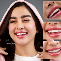 دندانپزشکی کامپوزیت لمینیت ایمپلنت بلیچینگ درمانی|خدمات آرایشگری و زیبایی|مشهد, سجاد شهر|دیوار