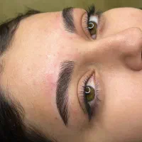 مدل میکروبلیدینگ