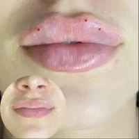 جراحی بینی ، پیکرتراشی ،لیپوماتیک، کاشت ابرو|خدمات آرایشگری و زیبایی|شهریار, شهریار|دیوار