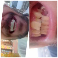 ترمیم و زیبایی|خدمات آرایشگری و زیبایی|یاسوج, |دیوار