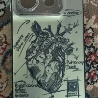 قاب نوت ۱۳پرو۵جی