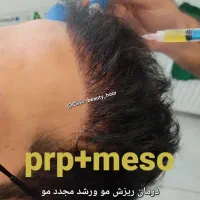 جشنواره تزریق ژل و فیلر بوتاکس کانتورینگ توسط پزشک|خدمات آرایشگری و زیبایی|سنندج, |دیوار