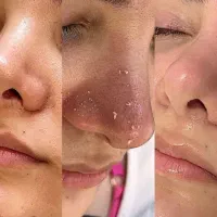 فشیال تخصصی / تخفیف تا شب یلدا