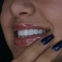 هلی کلینیک هر واحد کامپوزیت 800هزارتومان|خدمات آرایشگری و زیبایی|ایلام, |دیوار