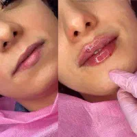 مدل ژل لب روسی و نچرال