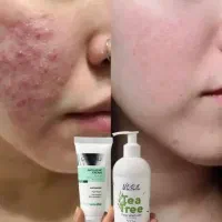 کرم آنتی آکنه بیومیمتیک ایتالیایی