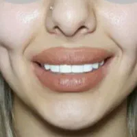 خدمات زیبایی تزریق در مطب